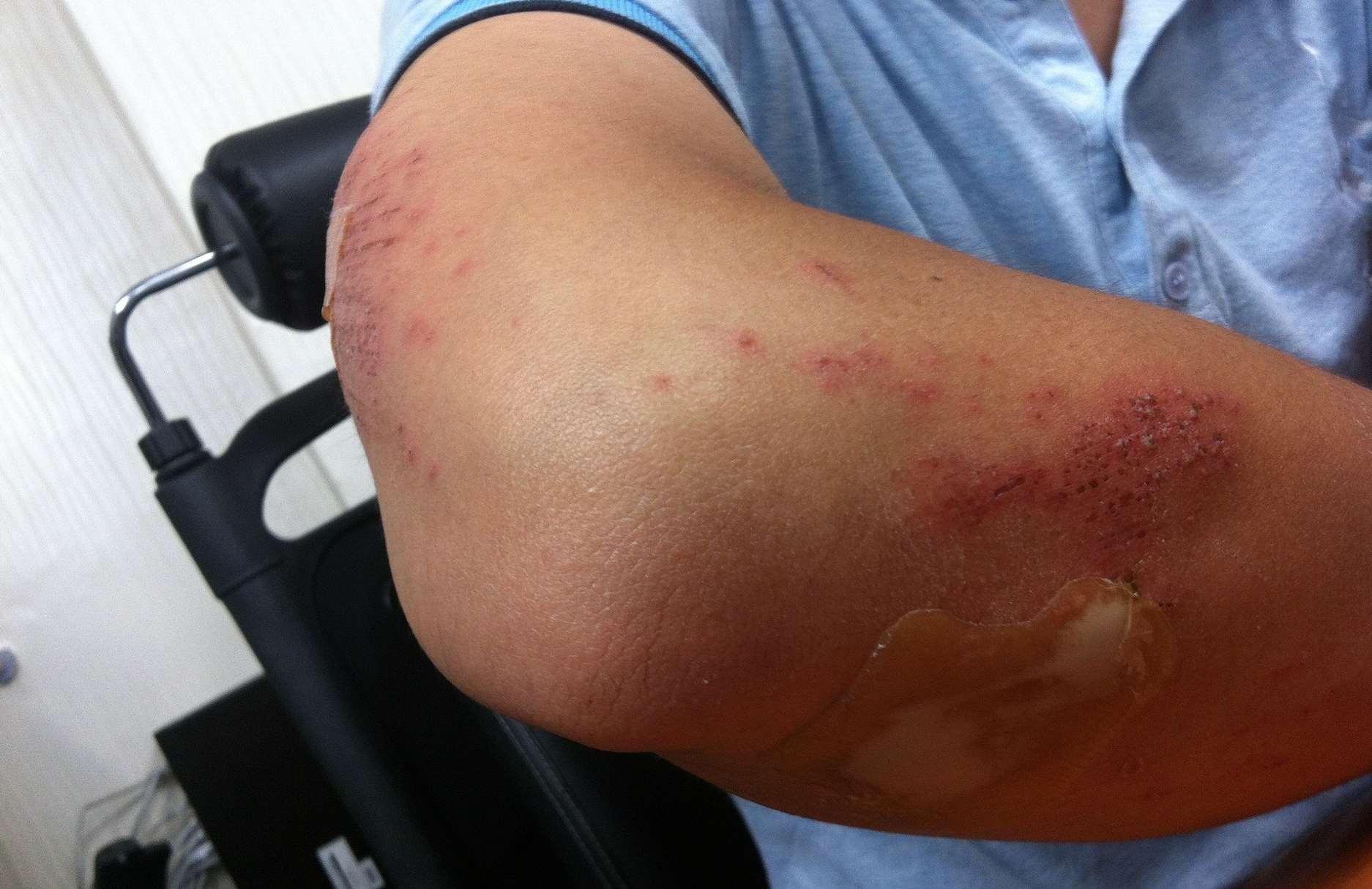 What is your accident risk on a motorbike?